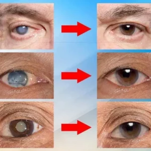 Japan Vision Drops — Rapidly Heals All Eye Conditions & Restores Vision image Japan Vision Drops — Rapidly Heals All Eye Conditions & Restores Vision