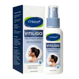 Cvreoz® Vitiligo Treatment Spray
