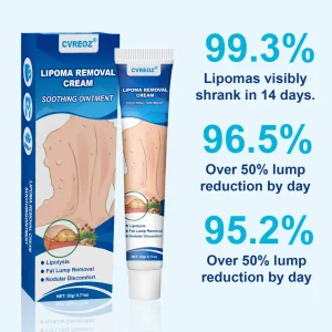 Cvreoz® Lipoma Removal Cream