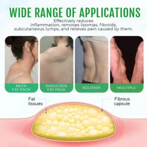 Cvreoz® DermaLump Relief Spray