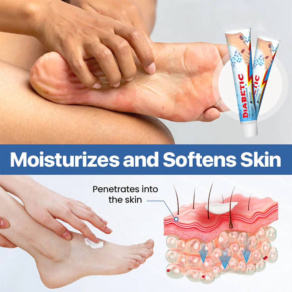 CVREOZ® BioVitaGlyco Diabetes Treatment Cream