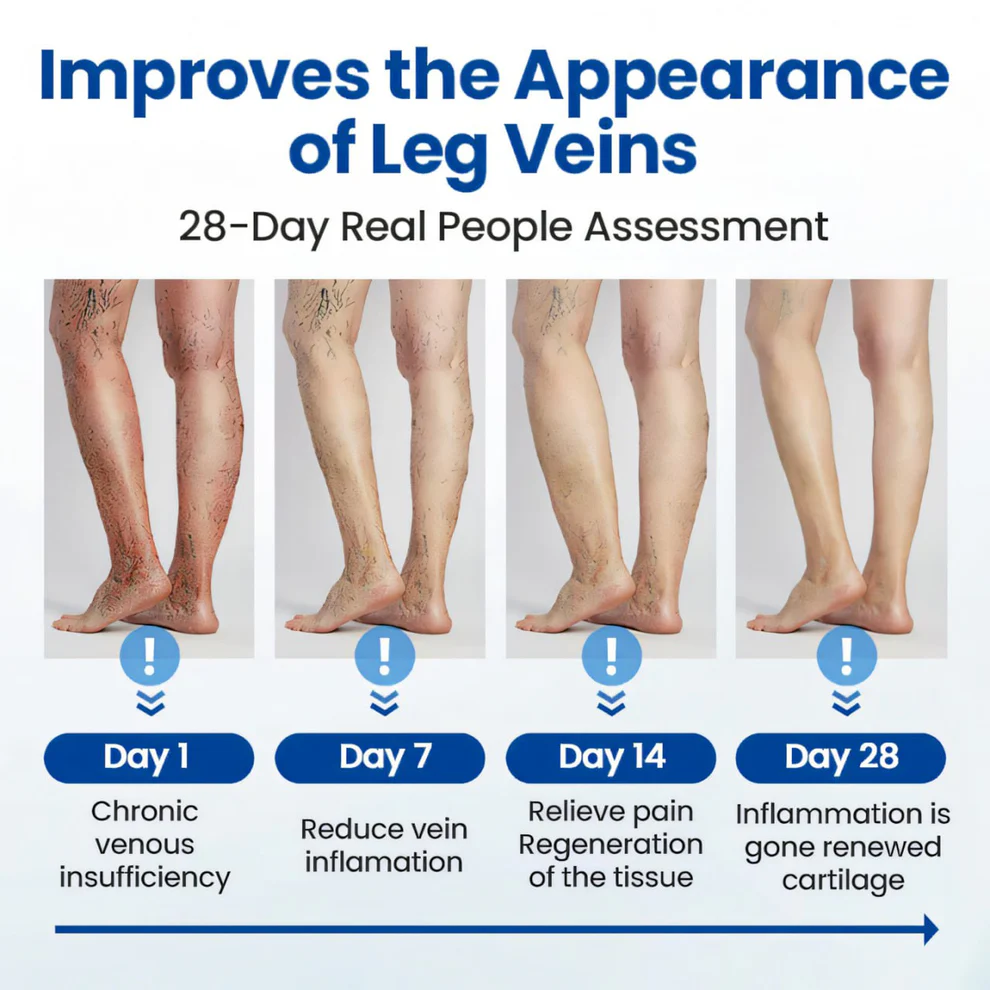Cvreoz® Varicose Veins Patch 9 Cvreoz® Varicose Veins Patch