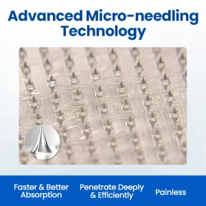 Cvreoz® Varicose Veins Patch 17 Cvreoz® Varicose Veins Patch