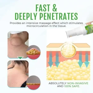 Cvreoz® DermaLump Relief Spray