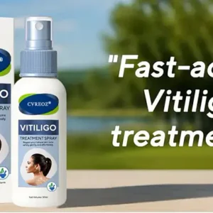 Cvreoz® Vitiligo Treatment Spray