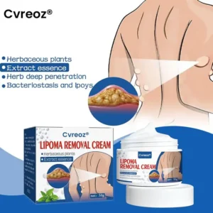 Cvreoz® Lipoma Removal Cream