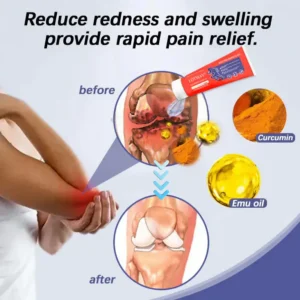 LOTMAY® Turmeric & Emu Oil Arthritis Soothing Pain Relief Massage Gel image LOTMAY® Turmeric & Emu Oil Arthritis Soothing Pain Relief Massage Gel