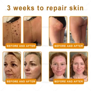 Daasry® Bee Venom Treatment Cream