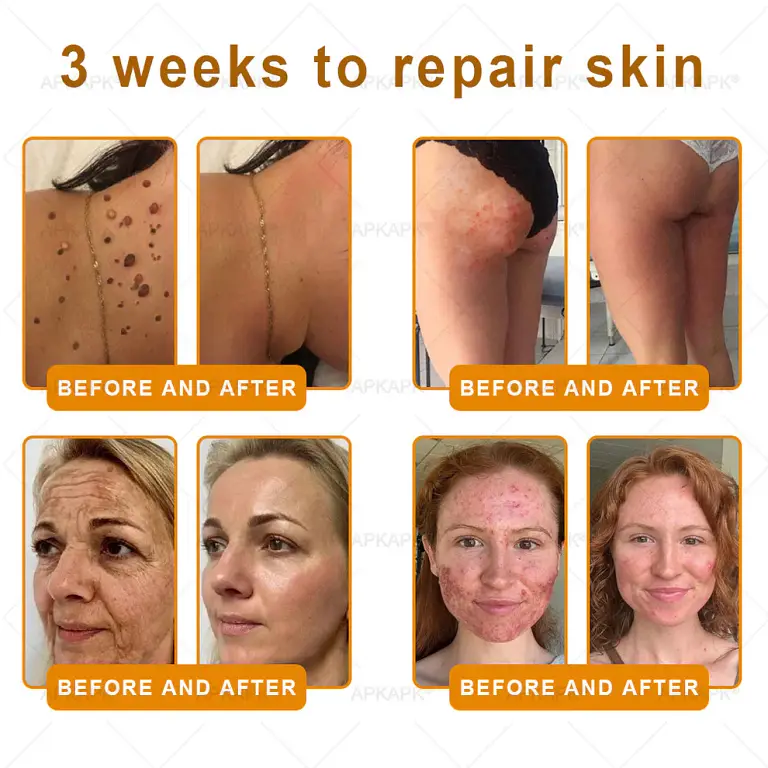 Daasry® Bee Venom Treatment Cream