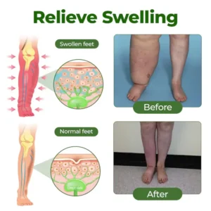 Timilk® FluidEase Leg Relief Edema Cream image Timilk® FluidEase Leg Relief Edema Cream