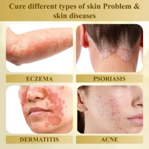 Cvreoz® Condense Mellifera Venom Skin Repairing Cream image Cvreoz® Condense Mellifera Venom Skin Repairing Cream