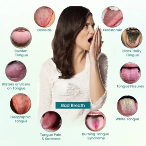 Timilk® GlosShield Tongue Repair Spray image Timilk® GlosShield Tongue Repair Spray