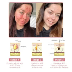 Awzlove™ Coenzyme Q10 Collagen Jelly Skin Cream