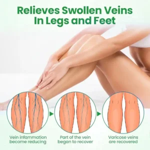 ADFIRE® VeinGuard Herbal Spray