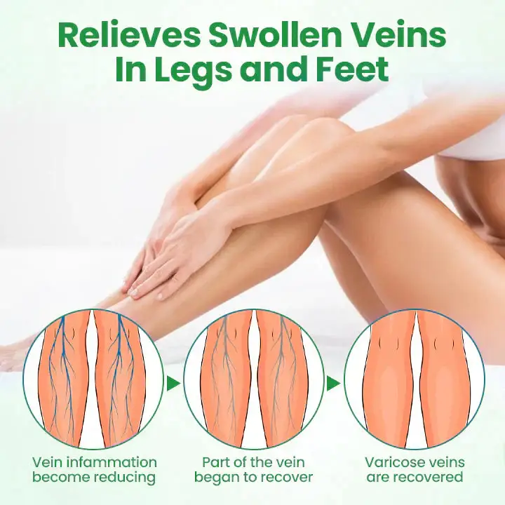 ADFIRE® VeinGuard Herbal Spray