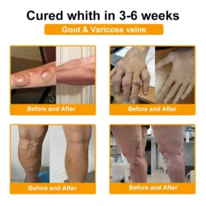 ADFIRE® Bee Venom Pain-Relief Bone Healing Spray