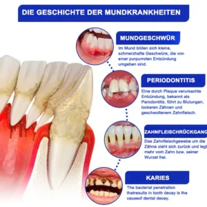 Dobshow® Bee Venom Dental Microgranules