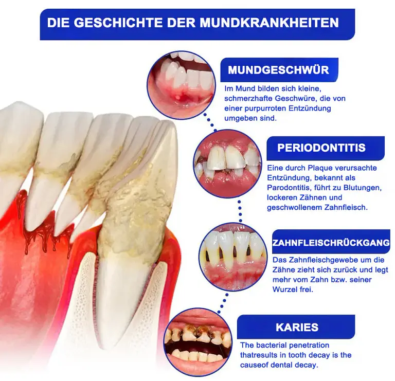 Dobshow® Bee Venom Dental Microgranules