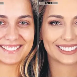 NESLEMY™Coconut Whitening Strips image NESLEMY™Coconut Whitening Strips