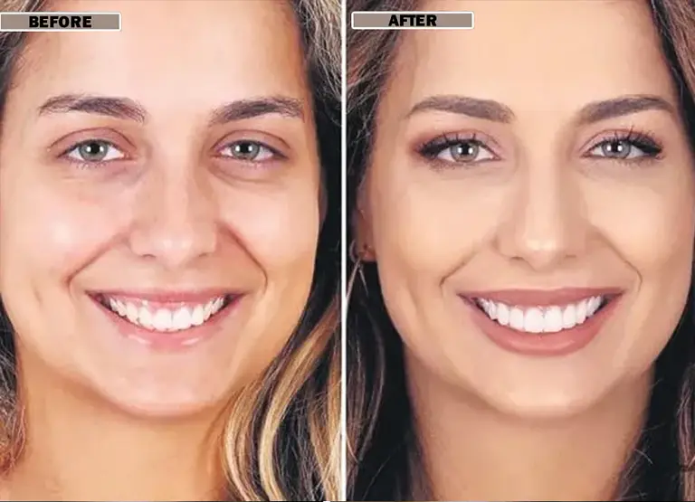 NESLEMY™Coconut Whitening Strips image NESLEMY™Coconut Whitening Strips