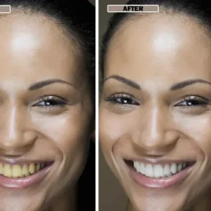 NESLEMY™Coconut Whitening Strips image NESLEMY™Coconut Whitening Strips