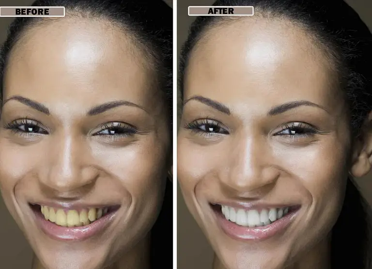 NESLEMY™Coconut Whitening Strips image NESLEMY™Coconut Whitening Strips