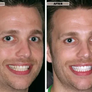 NESLEMY™Coconut Whitening Strips image NESLEMY™Coconut Whitening Strips