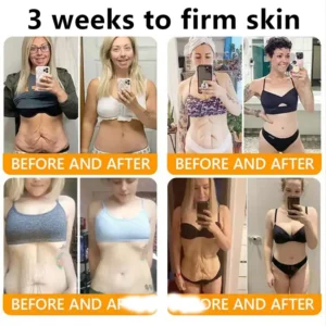 ADFIRE® Bee venom Comprehensive Cream image ADFIRE® Bee venom Comprehensive Cream