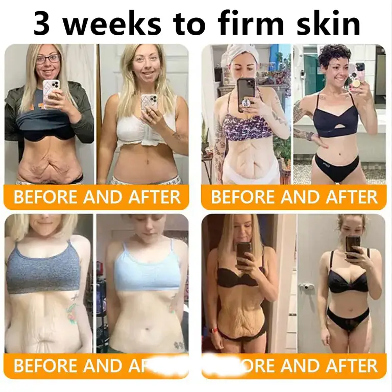 ADFIRE® Bee venom Comprehensive Cream image ADFIRE® Bee venom Comprehensive Cream