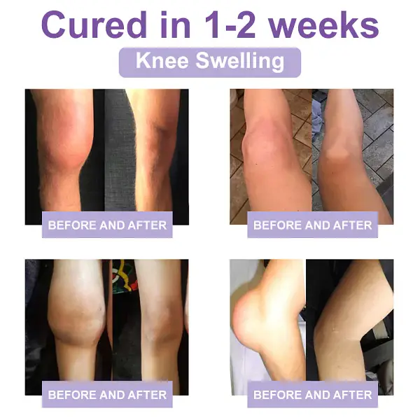 Zvoevo® Magnesium Pain Relief Cream