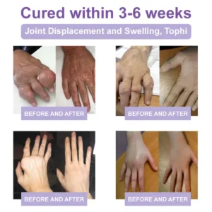 Zvoevo® Magnesium Pain Relief Cream