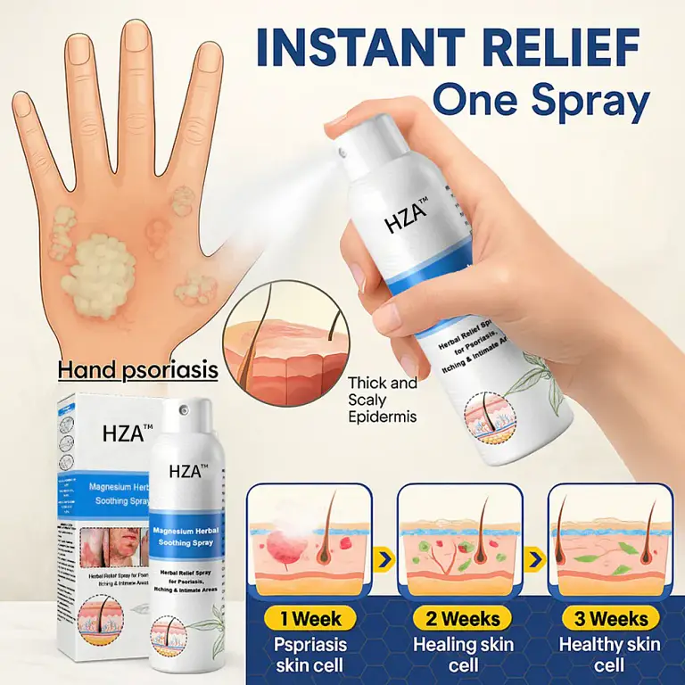 HZA™ Magnesium Herbal Psoriasis Spray