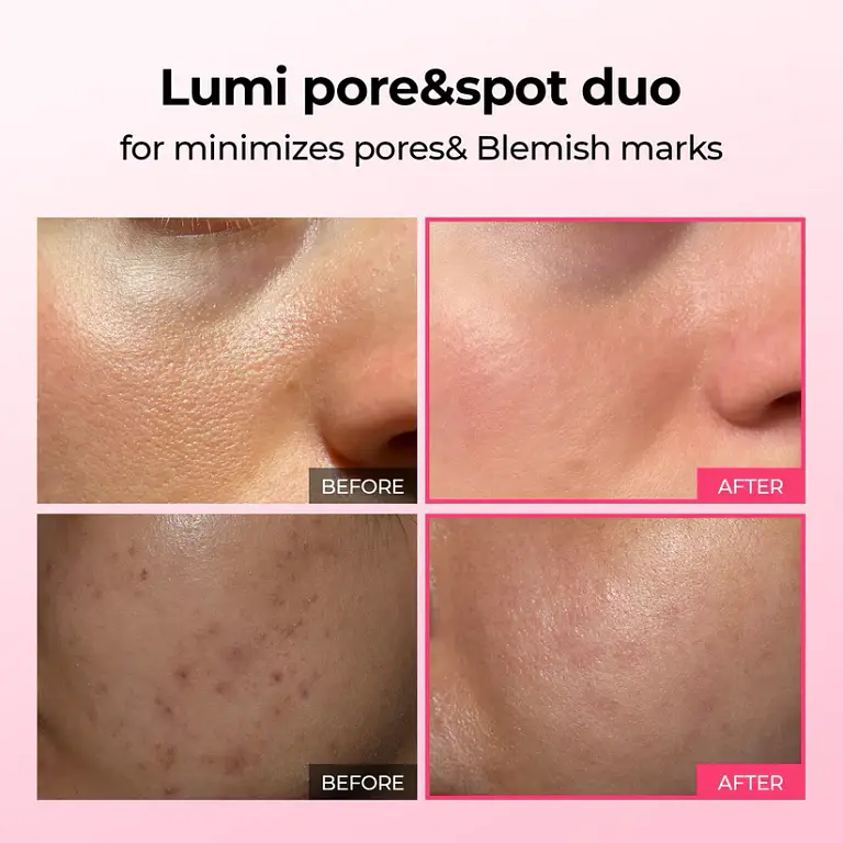 LUHAKA® Pore & Spot Care Duo