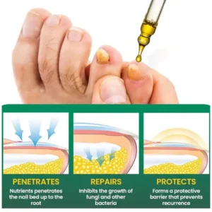 AEXZR® Fungal Nail Treatment