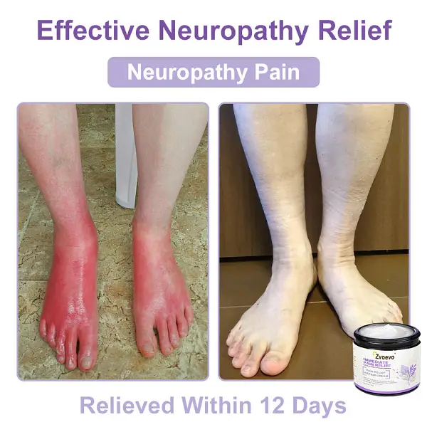 Zvoevo® Magnesium Pain Relief Cream