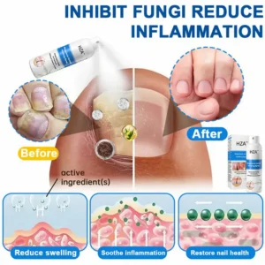 HZA™ Magnesium Herbal Psoriasis Spray