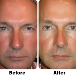 NESLEMY™ Nano Vision Repair Eye Serum