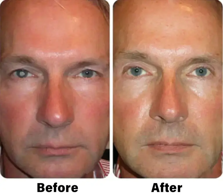 NESLEMY™ Nano Vision Repair Eye Serum