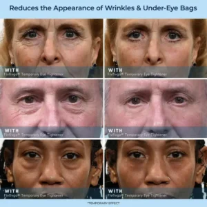 Fivfivgo® Temporary Eye Tightener + Free Brush