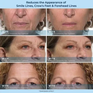 Fivfivgo® Temporary Eye Tightener + Free Brush