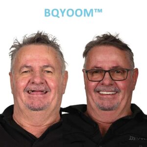 BQYOOMTM Dentures | Invisible Comfort, Natural Grip