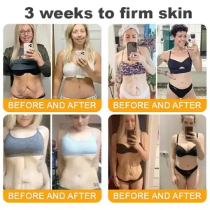 Taileden® Bee Venom Skin Restoration Cream