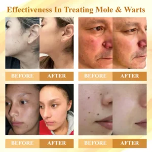 Fivfivgo® Condense Mellifera Venom Skin Repairing Cream