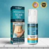 Cvreoz® Advanced Scar Gel