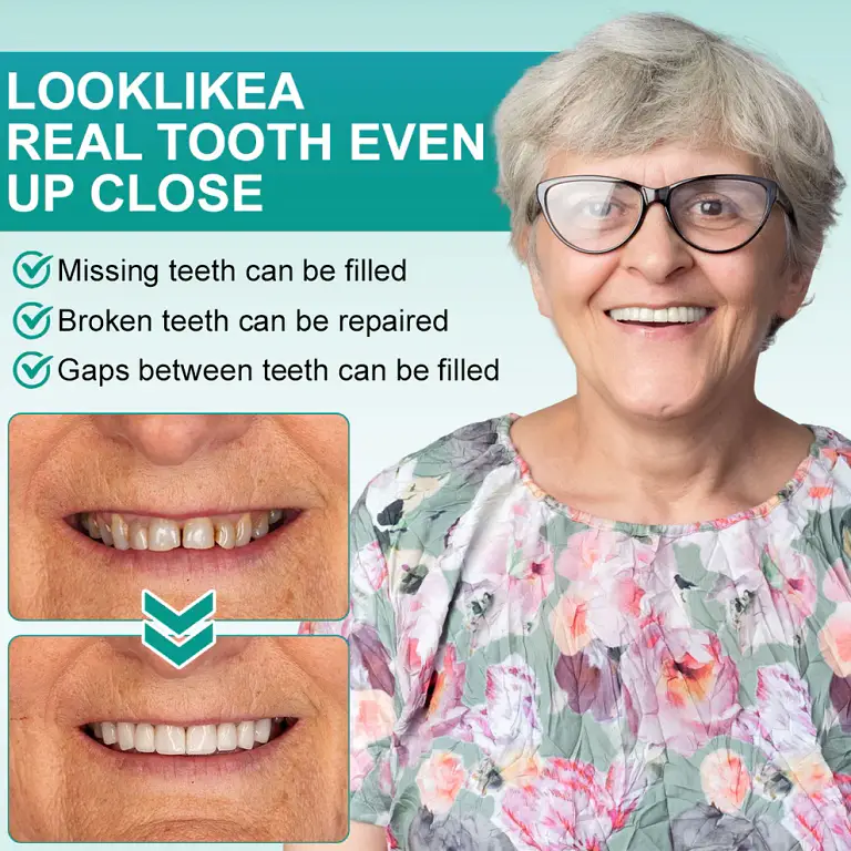 Ourlyard® Instant Stick on Dental Veneers image Ourlyard® Instant Stick on Dental Veneers