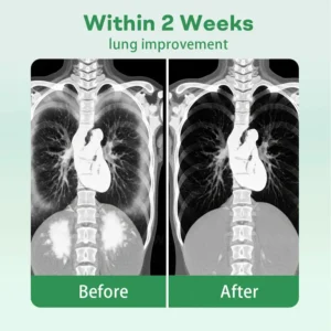 Cvreoz® Herbal Lung Cleansing Inhaler image Cvreoz® Herbal Lung Cleansing Inhaler