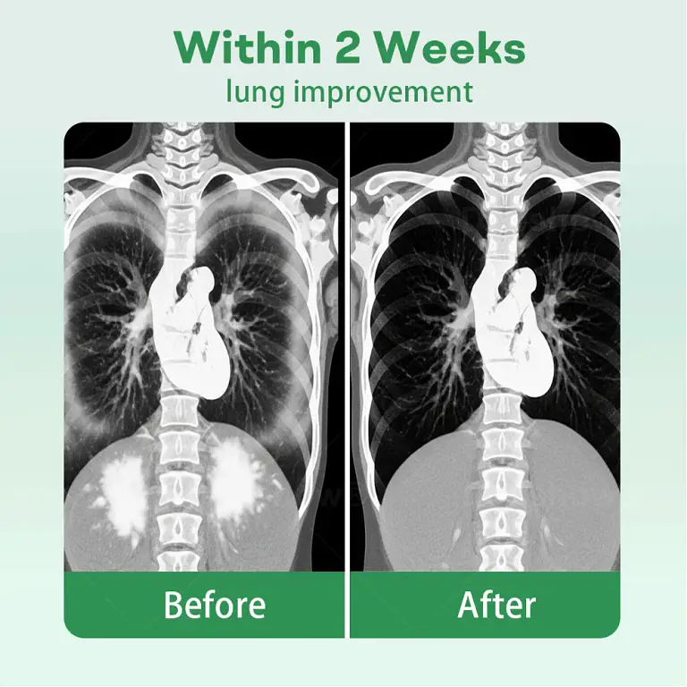 Cvreoz® Herbal Lung Cleansing Inhaler image Cvreoz® Herbal Lung Cleansing Inhaler