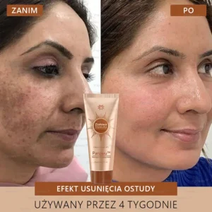 Parowu™ Whitening and Brightening Mask