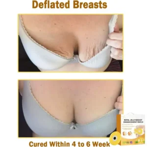Newyuo™ Royal Jelly Breast Enhancement Patch