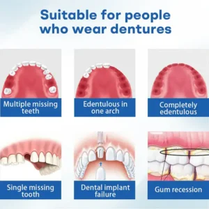 Nurbini® ThermoSeal Fresh Denture